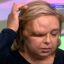 Женщина слепнет из-за огромной опухоли над глазом, которая разрослась на половину головы