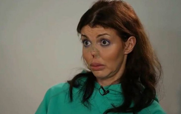 Истощенная сифилисом Алиса Аршавина на грани: &laquo;Мама, я жива! У меня есть волосы и нос!&raquo;