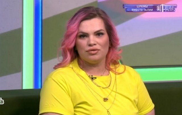 &laquo;Пупок исчез, руки и живот в страшных шрамах&raquo;: тело женщины изуродовали неудачной пластикой